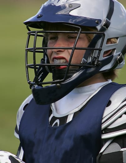 Custom Mouth Guards in Revelstoke